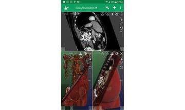 Droid Dicom Viewer for Android - Download the APK from Habererciyes